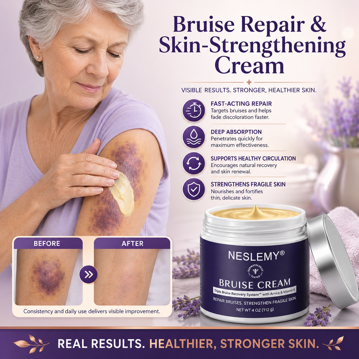 💥100K+ SOLD💕- NESLEMY® Bruise Repair & Skin-Strengthening Cream